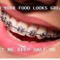 i have braces :)
