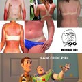 cáncer de piel
